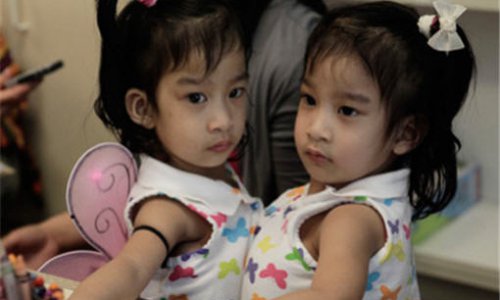 В США проведена операция по разделению сиамских близнецов с Филиппин