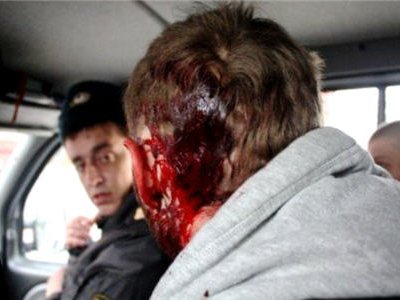 В Москве в результате конфликта с уроженцами Северного Кавказа ранен стажер ГИБДД